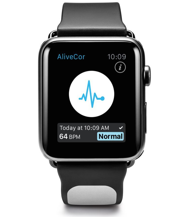 Apple Watch trong tương lai sẽ giúp ngăn ngừa đột quỵ