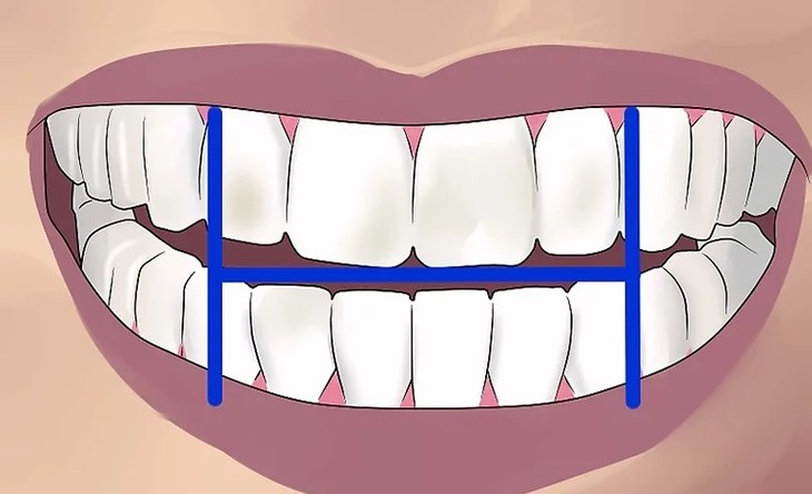 quy trình đánh răng - hình 1