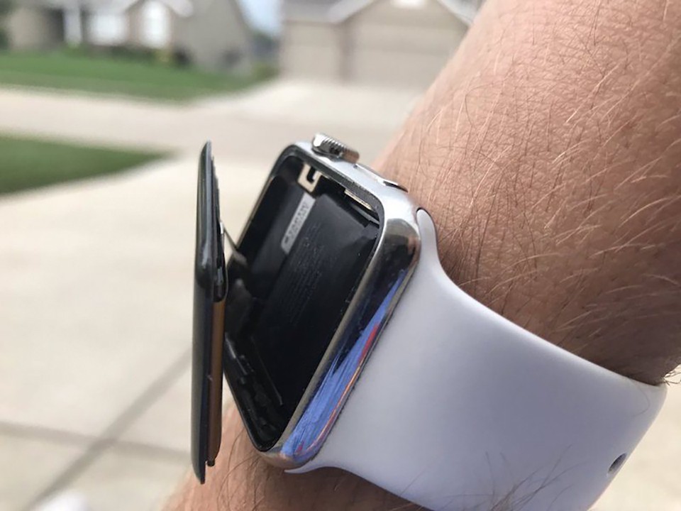 Apple Watch bị phồng pin